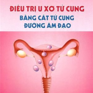 [Gốc] Điều Trị U Xơ Tử Cung Bằng Cắt Tử Cung Đường Âm Đạo - 2014 - Cuốn